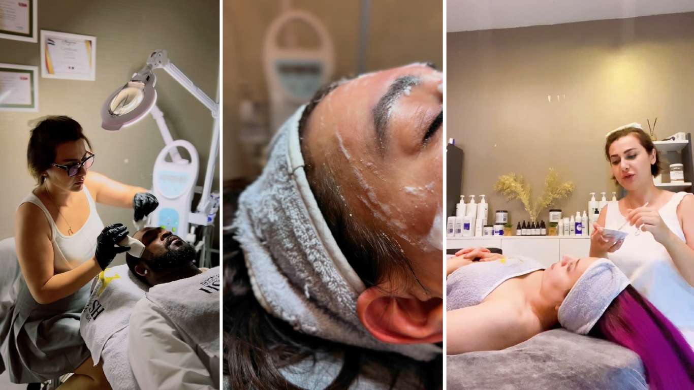 درمان جوش و منافذ باز در استانبول؛ تعادل پوست، شفافیت دوباره